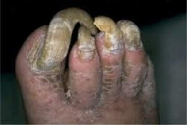 Kicsit elhanyagoltam a körmeimet mostanság