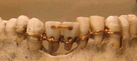 Úgy érzem fogtechnikus leszek