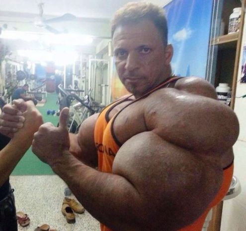 Úgy hívják a cuccot - Synthol 🙁