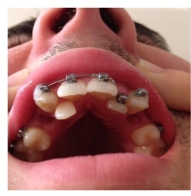 Elég szarul néz ki