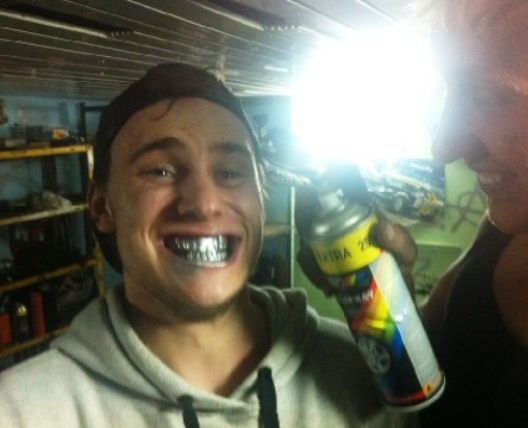 Már nem az aranyfog a menő!