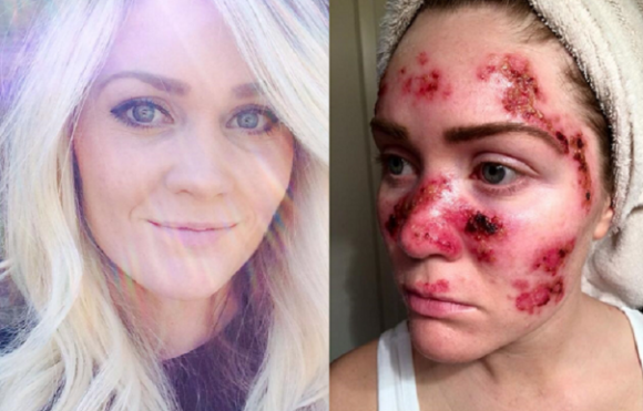 Ezért nem érdemes túlzásba vinni a szolizást