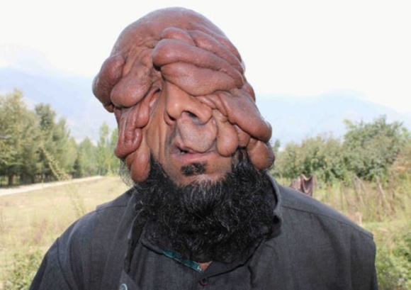 Az arcnélküli ember