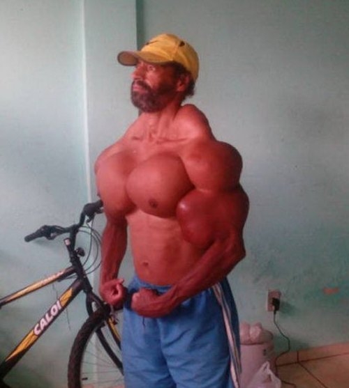 Szintol (Synthol) huszár