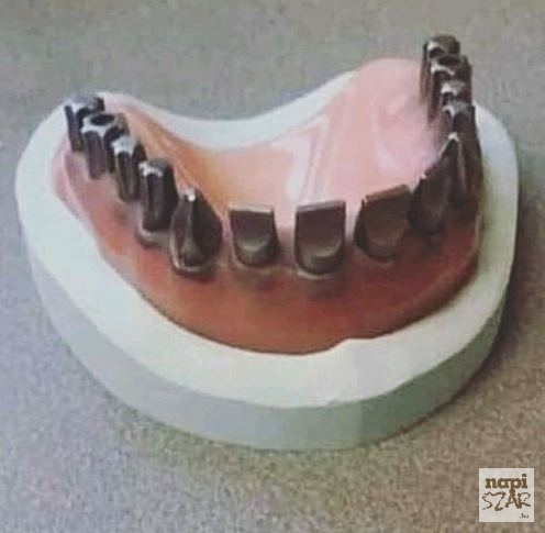 Amikor a szerszámboltban készítik a fogsorod