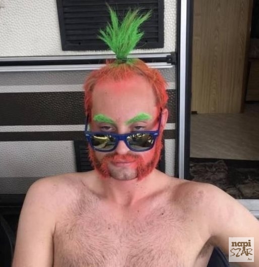 Jó a sérod bátyja!