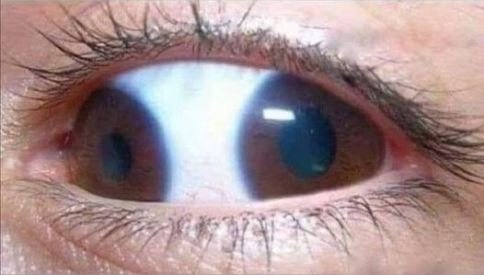 Egy nő szeme, amikor bemegy egy ruhaboltba