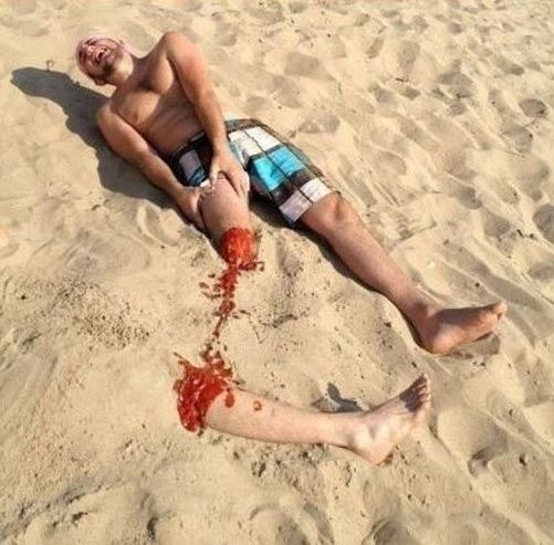 Bizarr tréfa a strandon