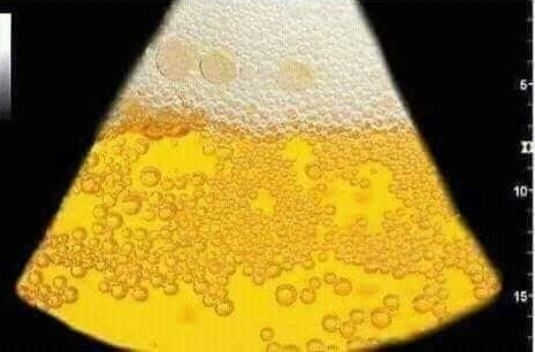 Egy csomó ismerősöm posztolt ultrahangos képet