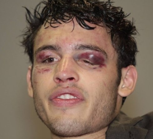 Megemlítettem az asszonynak, hogy kezd picit elhízni