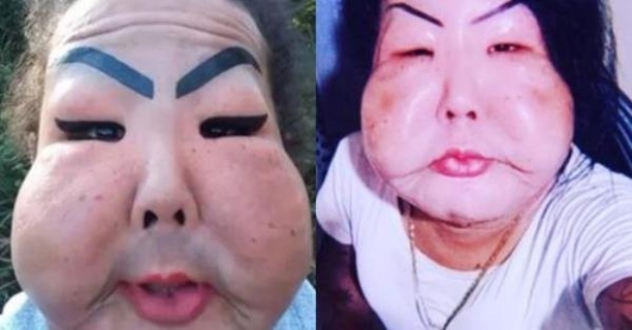 Napi pöffeteg gomba