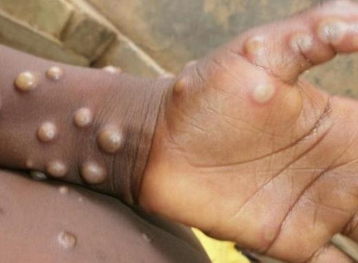 E heti jótanácsunk - NE KÚRJ MAJOMMAL!