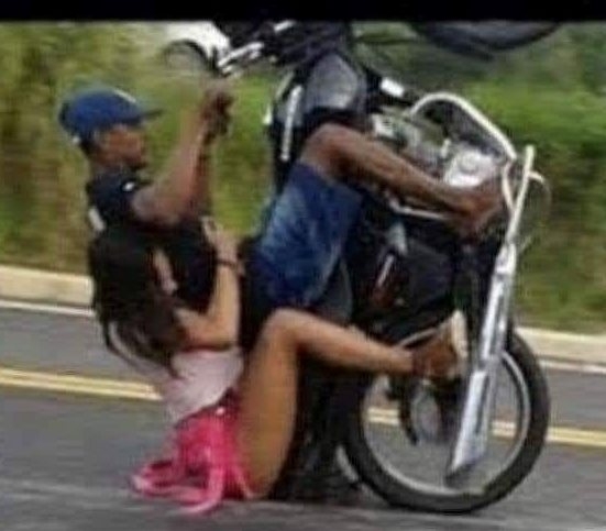 Végleges szőrtelenítés, olcsón, gyorsan