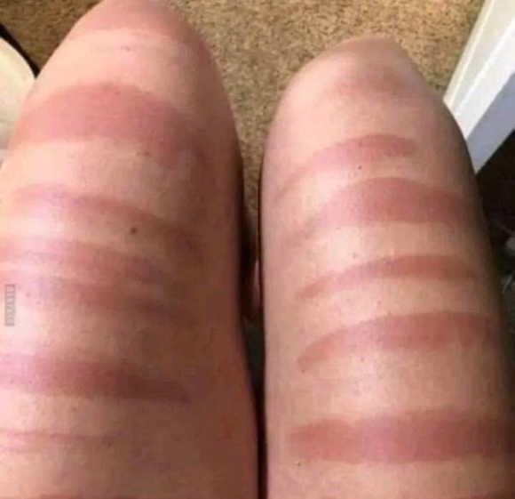 A perzselő napsütés és a szakadt farmer