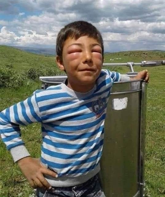 A méhészkedés egyik előnye