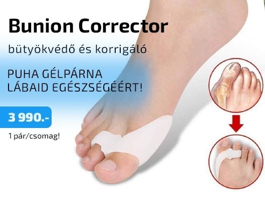 Leszámolnál a fájdalmas bütyökkel? (x)