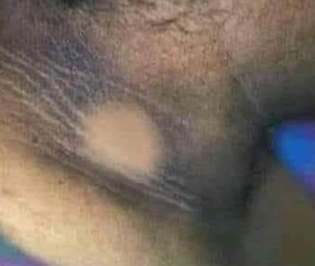 Amikor kiszívod a nyakát, de csak egy tiszta folt marad a helyén