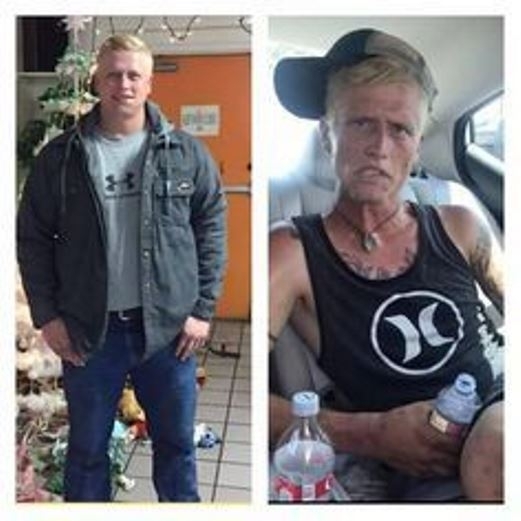 Ez történik, ha valaki rácsúszik a heroinra