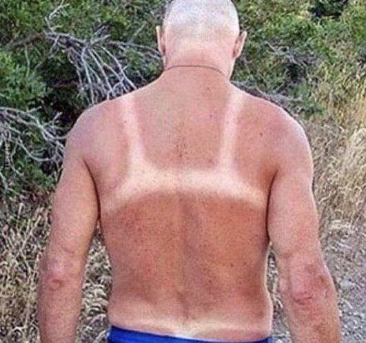 Fedetlen bikinivonal