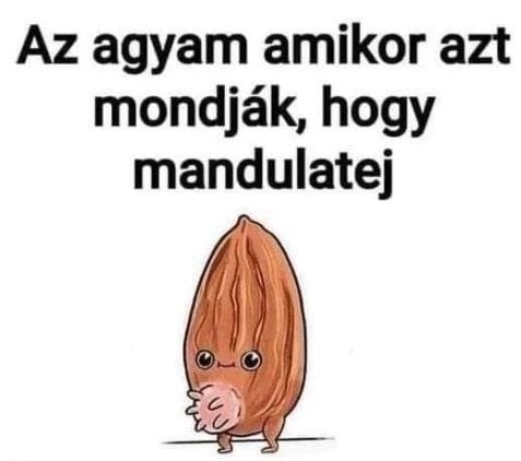 Neked milyen kép ugrik be, amikor meghallod ezt a szót?